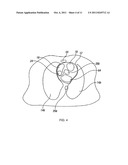 IMPROVED MONITOR OF HEART FAILURE USING BIOIMPEDANCE diagram and image