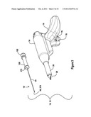 TISSUE EXCISION DEVICE diagram and image