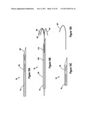 TISSUE EXCISION DEVICE diagram and image