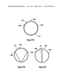 TISSUE EXCISION DEVICE diagram and image