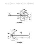 TISSUE EXCISION DEVICE diagram and image