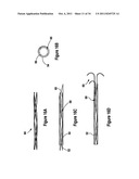 TISSUE EXCISION DEVICE WITH A COLLAPSIBLE STYLET diagram and image