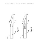 TISSUE EXCISION DEVICE WITH A COLLAPSIBLE STYLET diagram and image