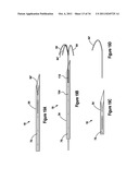 TISSUE EXCISION DEVICE WITH A COLLAPSIBLE STYLET diagram and image