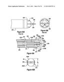 TISSUE EXCISION DEVICE WITH A COLLAPSIBLE STYLET diagram and image