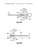 TISSUE EXCISION DEVICE WITH A COLLAPSIBLE STYLET diagram and image