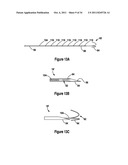 TISSUE EXCISION DEVICE WITH AN INDEPENDENT NEEDLE diagram and image