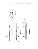 TISSUE EXCISION DEVICE WITH AN INDEPENDENT NEEDLE diagram and image