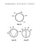 TISSUE EXCISION DEVICE WITH AN INDEPENDENT NEEDLE diagram and image