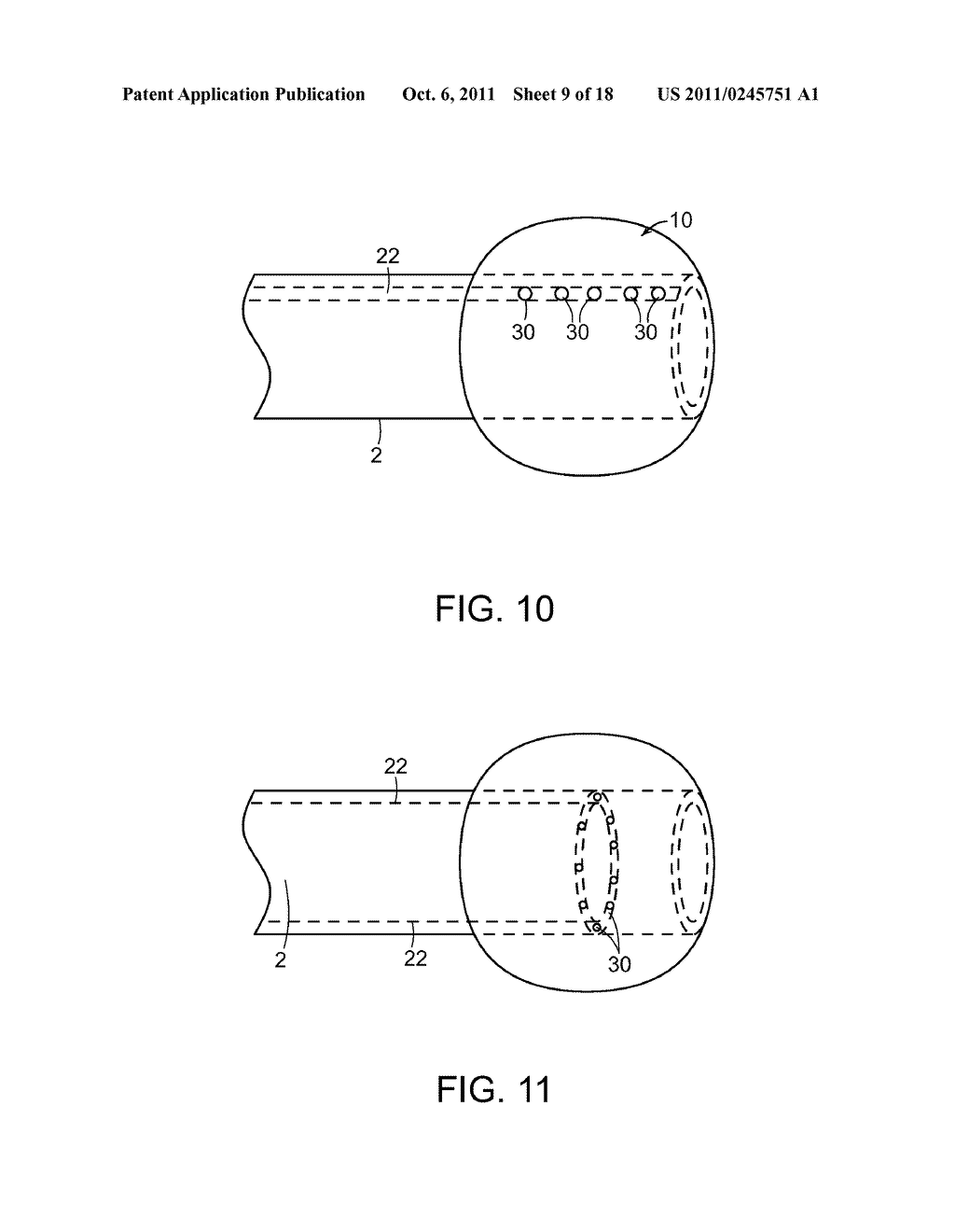 METHODS AND DEVICES FOR PERCUTANEOUS AND SURGICAL INTERVENTIONS - diagram, schematic, and image 10