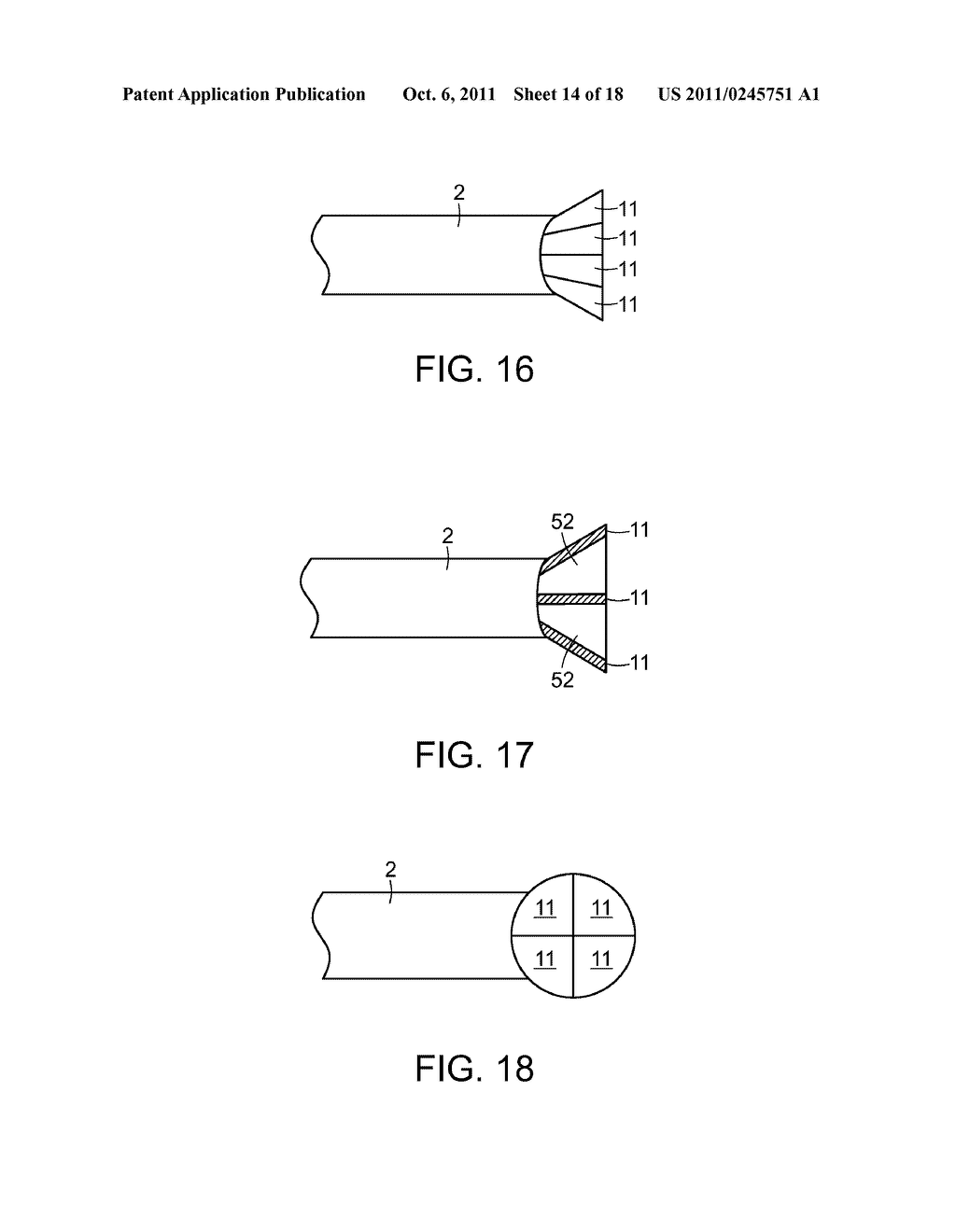 METHODS AND DEVICES FOR PERCUTANEOUS AND SURGICAL INTERVENTIONS - diagram, schematic, and image 15