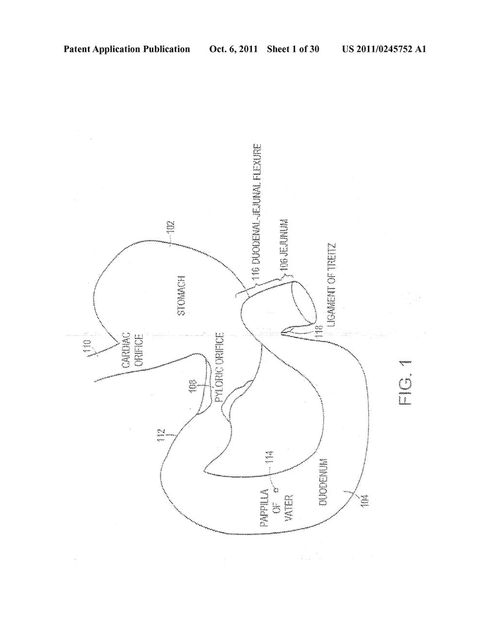 METHODS OF TREATMENT USING A BARIATRIC SLEEVE - diagram, schematic, and image 02