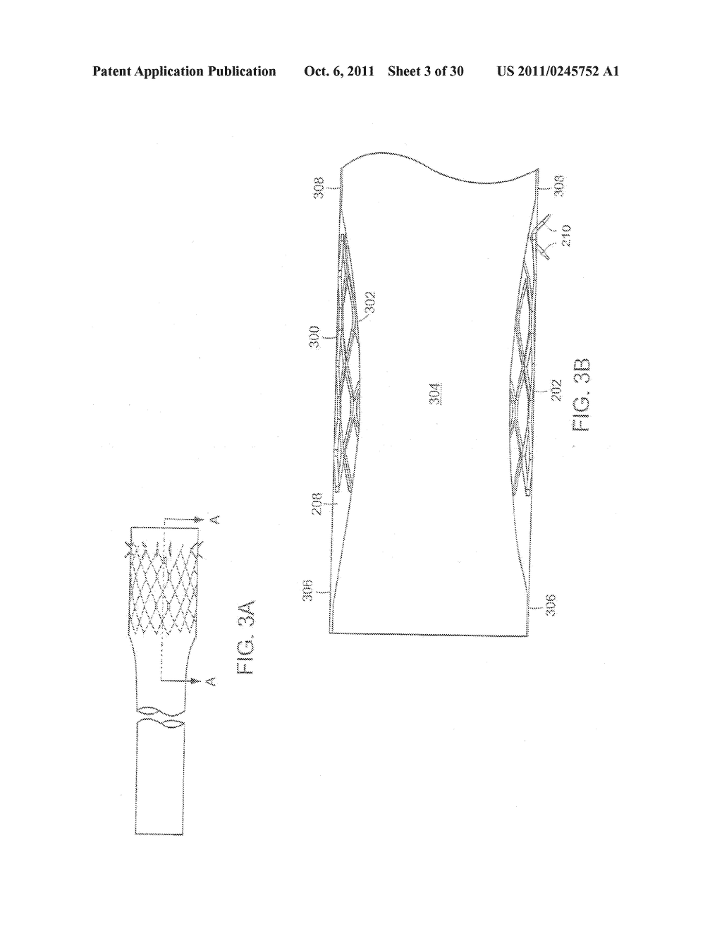 METHODS OF TREATMENT USING A BARIATRIC SLEEVE - diagram, schematic, and image 04