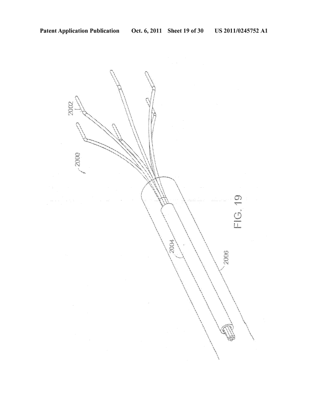 METHODS OF TREATMENT USING A BARIATRIC SLEEVE - diagram, schematic, and image 20