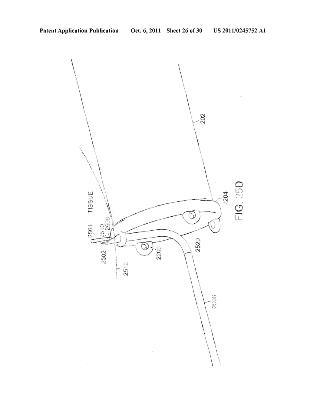 METHODS OF TREATMENT USING A BARIATRIC SLEEVE - diagram, schematic, and image 27