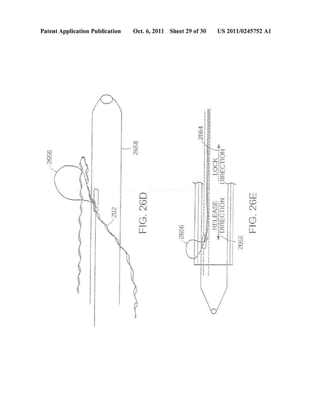 METHODS OF TREATMENT USING A BARIATRIC SLEEVE - diagram, schematic, and image 30