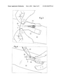 DRESSING FOR FIXING AND PROTECTING A NEEDLE diagram and image