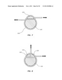 REINFORCED MULTI-LUMEN CATHETER AND METHODS FOR MAKING SAME diagram and image