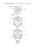 REINFORCED MULTI-LUMEN CATHETER AND METHODS FOR MAKING SAME diagram and image