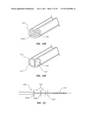 REINFORCED MULTI-LUMEN CATHETER AND METHODS FOR MAKING SAME diagram and image