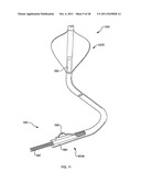 DEFLECTABLE SHEATH CATHETERS diagram and image