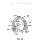 DEFLECTABLE SHEATH CATHETERS diagram and image