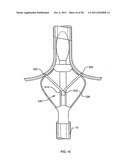 DEFLECTABLE SHEATH CATHETERS diagram and image