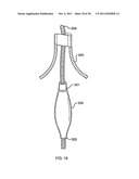 DEFLECTABLE SHEATH CATHETERS diagram and image