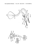 DEFLECTABLE SHEATH CATHETERS diagram and image