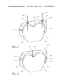 Surgical Instrument diagram and image