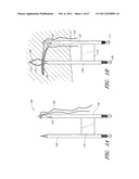 SUTURE PASSER SYSTEMS AND METHODS FOR TONGUE OR OTHER TISSUE SUSPENSION     AND COMPRESSION diagram and image