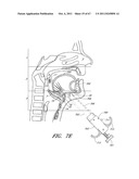 SUTURE PASSER SYSTEMS AND METHODS FOR TONGUE OR OTHER TISSUE SUSPENSION     AND COMPRESSION diagram and image