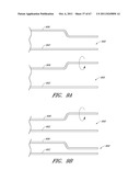 SUTURE PASSER SYSTEMS AND METHODS FOR TONGUE OR OTHER TISSUE SUSPENSION     AND COMPRESSION diagram and image