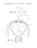 SUTURE PASSER SYSTEMS AND METHODS FOR TONGUE OR OTHER TISSUE SUSPENSION     AND COMPRESSION diagram and image