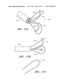 SUTURE PASSER SYSTEMS AND METHODS FOR TONGUE OR OTHER TISSUE SUSPENSION     AND COMPRESSION diagram and image