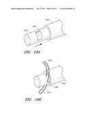 SUTURE PASSER SYSTEMS AND METHODS FOR TONGUE OR OTHER TISSUE SUSPENSION     AND COMPRESSION diagram and image