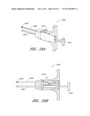 SUTURE PASSER SYSTEMS AND METHODS FOR TONGUE OR OTHER TISSUE SUSPENSION     AND COMPRESSION diagram and image