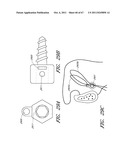 SUTURE PASSER SYSTEMS AND METHODS FOR TONGUE OR OTHER TISSUE SUSPENSION     AND COMPRESSION diagram and image