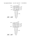 SUTURE PASSER SYSTEMS AND METHODS FOR TONGUE OR OTHER TISSUE SUSPENSION     AND COMPRESSION diagram and image