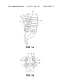 METHOD OF CONNECTING TRANSVERSE BEAM AT TRIANGULAR POSITION OF VERTEBRAL     LAMINA diagram and image