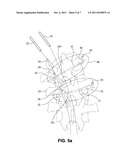 METHOD OF CONNECTING TRANSVERSE BEAM AT TRIANGULAR POSITION OF VERTEBRAL     LAMINA diagram and image