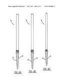 SPINAL FIXATOR AND METHOD OF USE THEREOF diagram and image