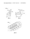 METHOD OF FABRICATING IMPLANTABLE PULSE GENERATOR USING WIRE CONNECTIONS     TO FEEDTHROUGH STRUCTURES AND IMPLANTABLE PULSE GENERATORS diagram and image