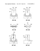 METHOD OF FABRICATING IMPLANTABLE PULSE GENERATOR USING WIRE CONNECTIONS     TO FEEDTHROUGH STRUCTURES AND IMPLANTABLE PULSE GENERATORS diagram and image