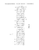 EXPANDABLE SLIDE AND LOCK STENT diagram and image