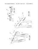 EXPANDABLE SLIDE AND LOCK STENT diagram and image