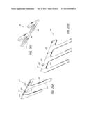 EXPANDABLE SLIDE AND LOCK STENT diagram and image