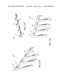 EXPANDABLE SLIDE AND LOCK STENT diagram and image