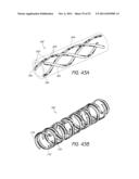 EXPANDABLE SLIDE AND LOCK STENT diagram and image