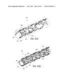 EXPANDABLE SLIDE AND LOCK STENT diagram and image